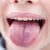 bài thuốc nam chữa viêm lưỡi