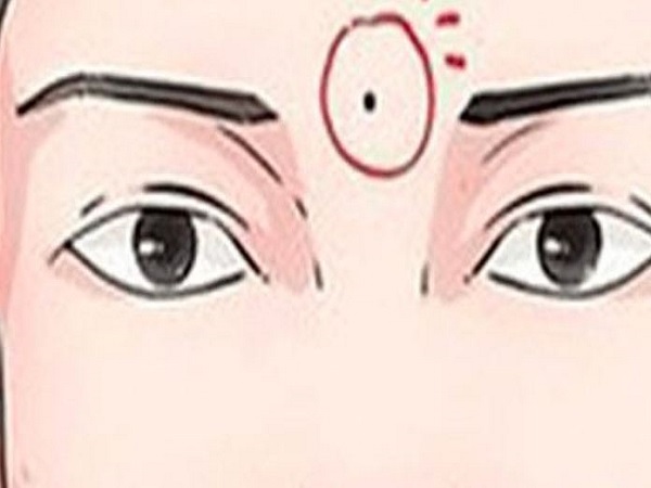 Mụn ruồi ở ấn đường nữ giới và nam giới khác nhau thế nào?