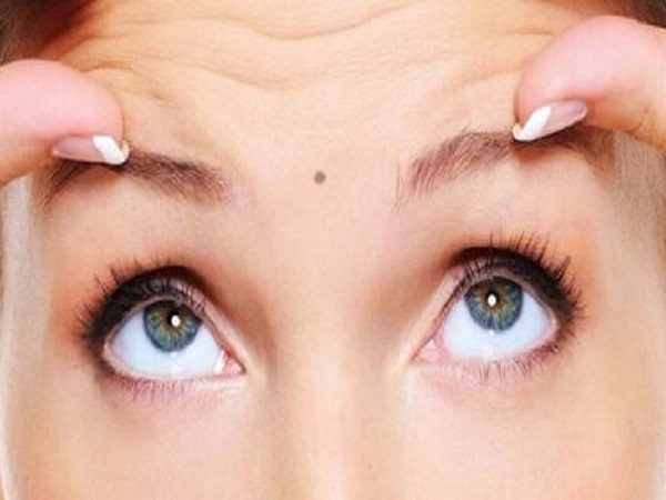 Ý nghĩa chung của nốt ruồi ở ấn đường